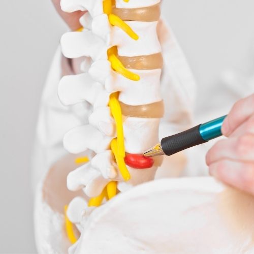 bel fıtığı1 bel fıtığı1